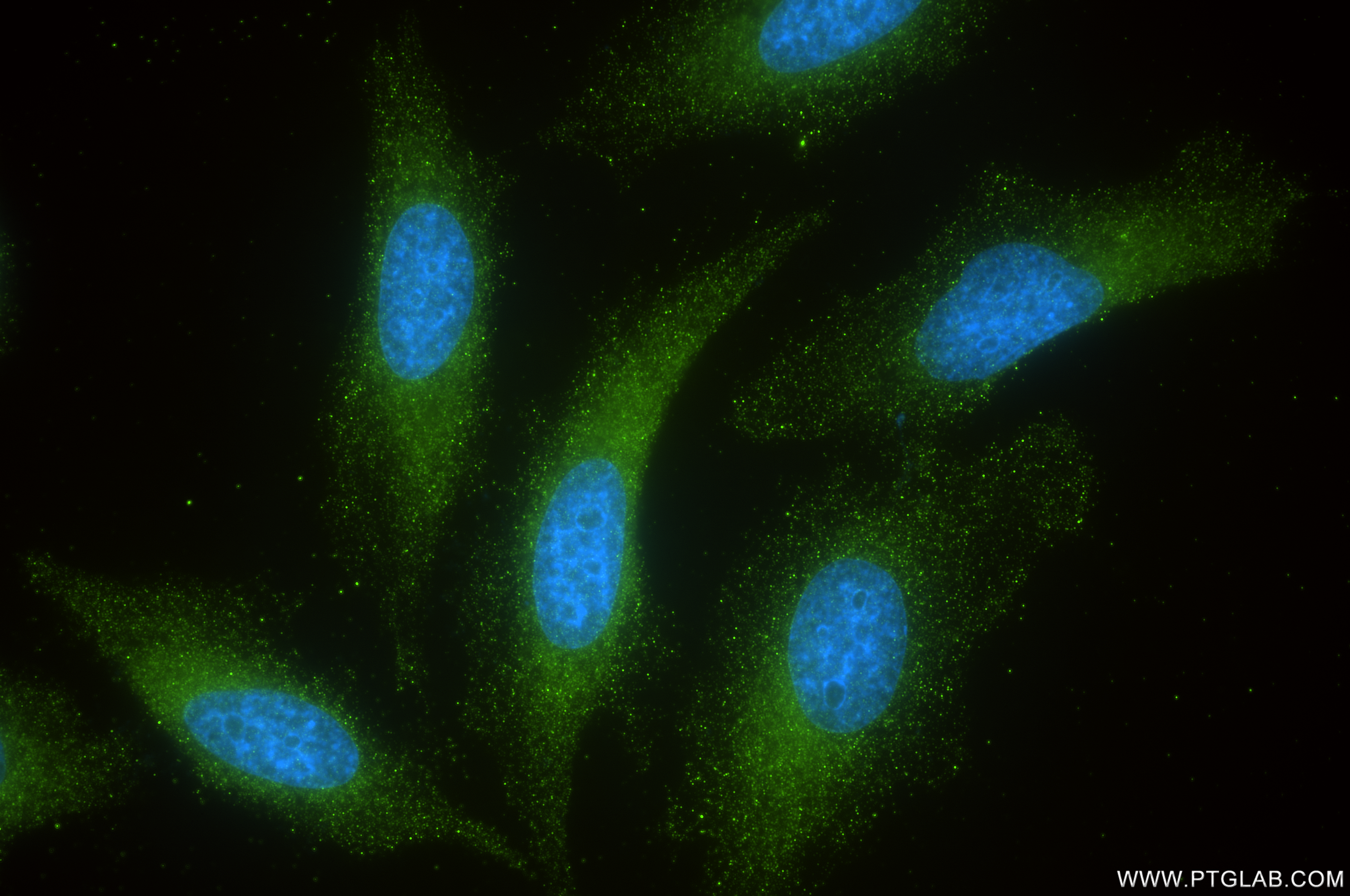 Immunofluorescence (IF) / fluorescent staining of HeLa cells using USP33 Recombinant antibody (84958-1-RR)