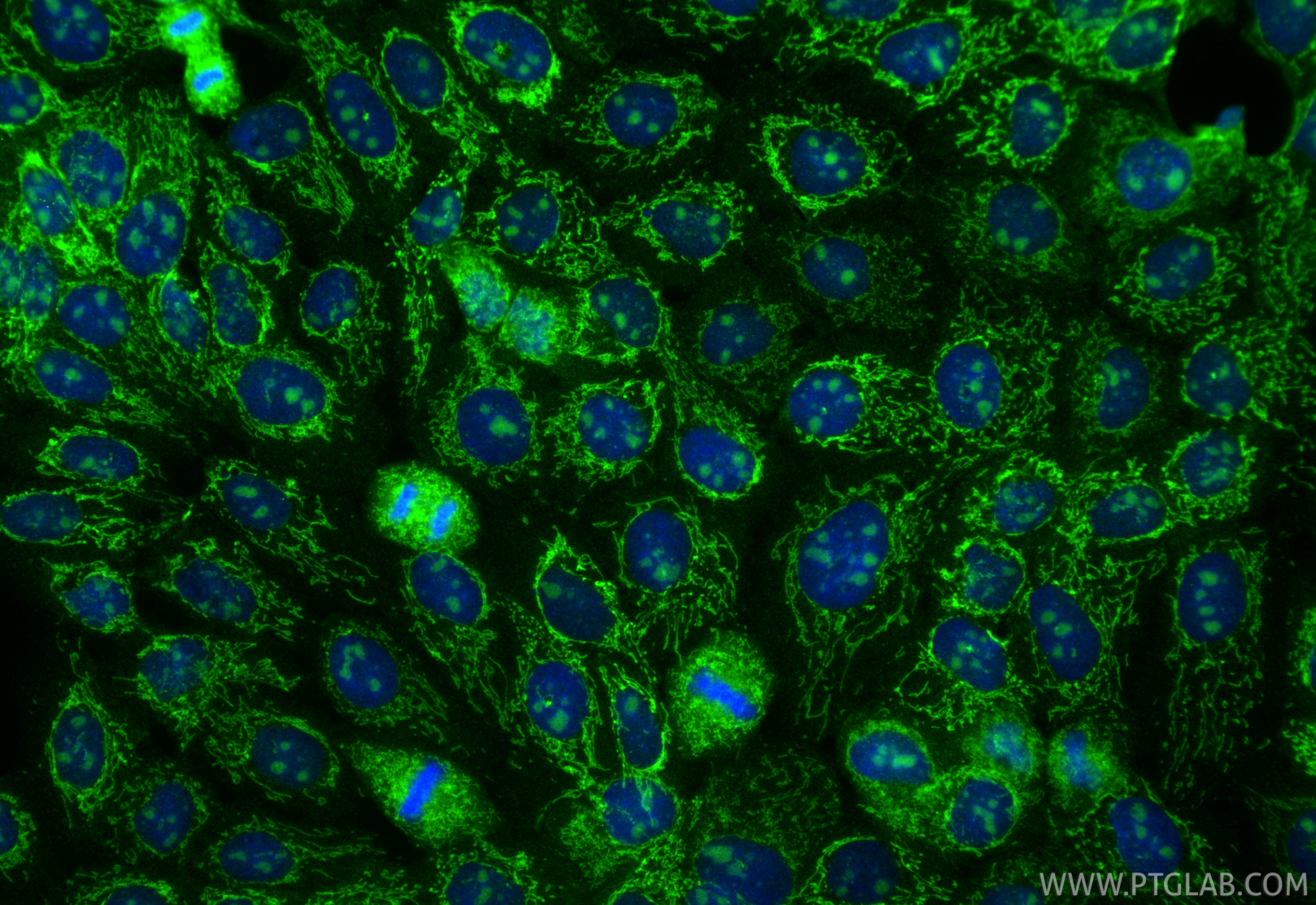 Immunofluorescence (IF) / fluorescent staining of A431 cells using USP36 Polyclonal antibody (14783-1-AP)