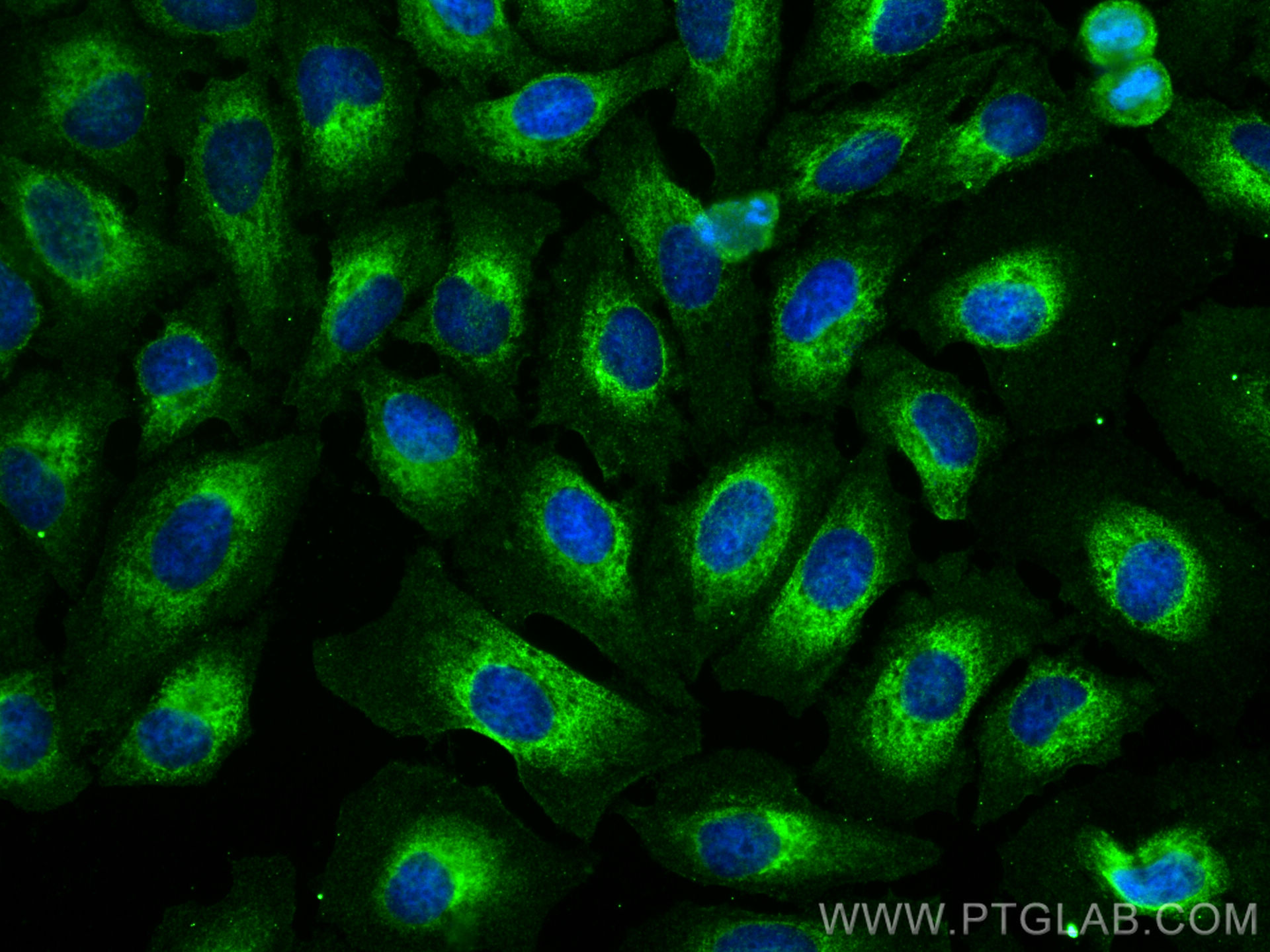 Immunofluorescence (IF) / fluorescent staining of HeLa cells using USP36 Monoclonal antibody (68165-1-Ig)