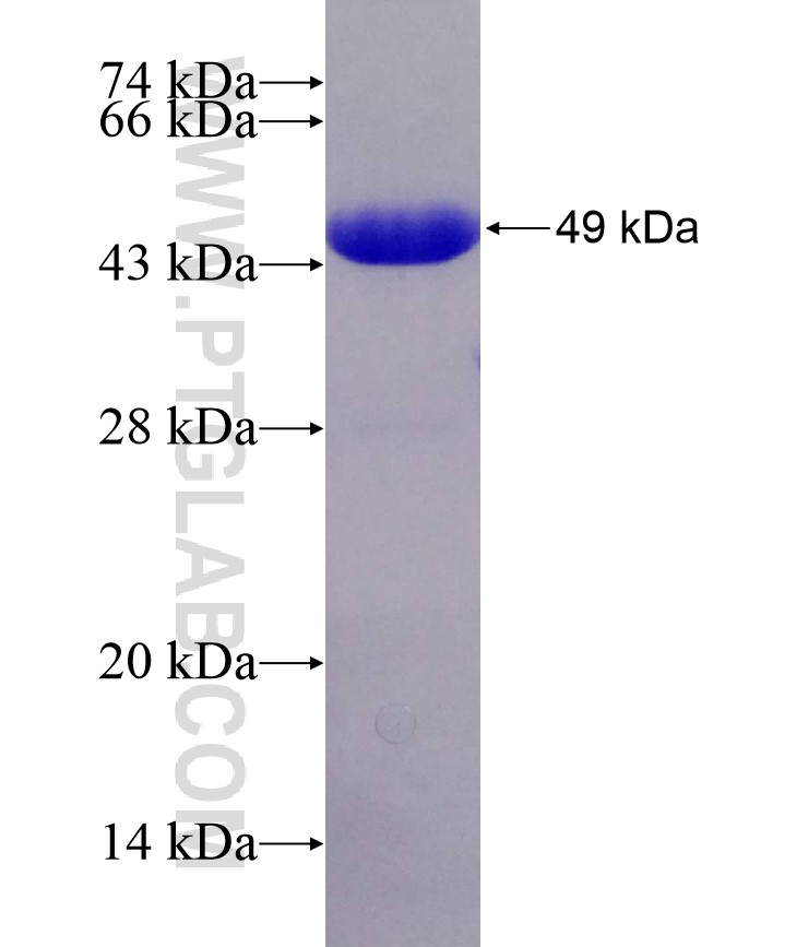 USP37 fusion protein Ag29037 SDS-PAGE