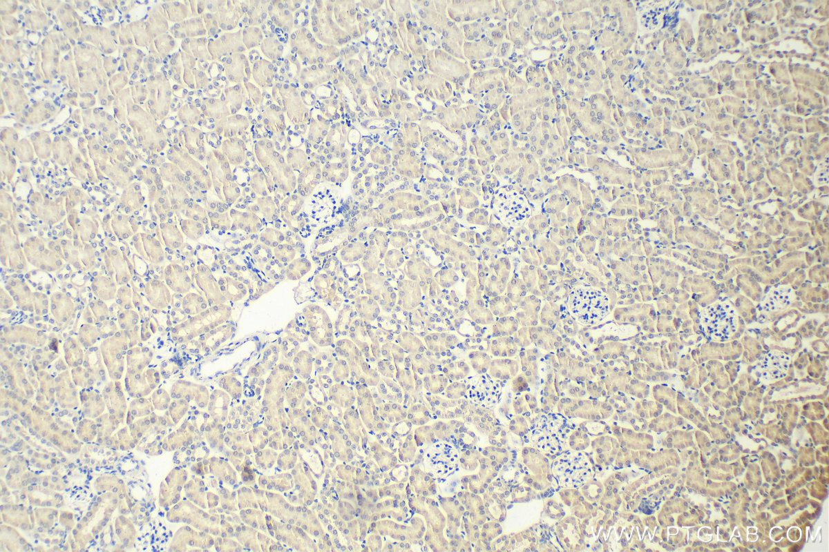 Immunohistochemistry (IHC) staining of mouse kidney tissue using USP4 Monoclonal antibody (66822-1-Ig)