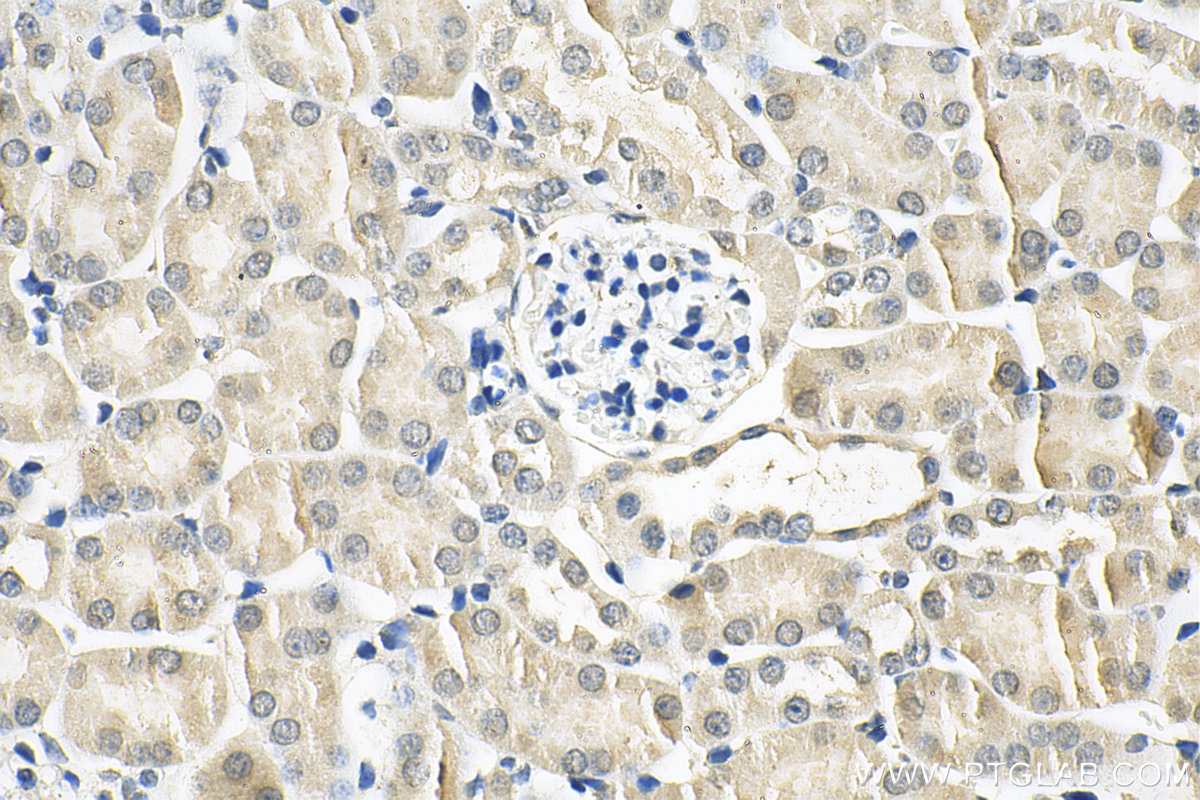 Immunohistochemistry (IHC) staining of mouse kidney tissue using USP4 Monoclonal antibody (66822-1-Ig)