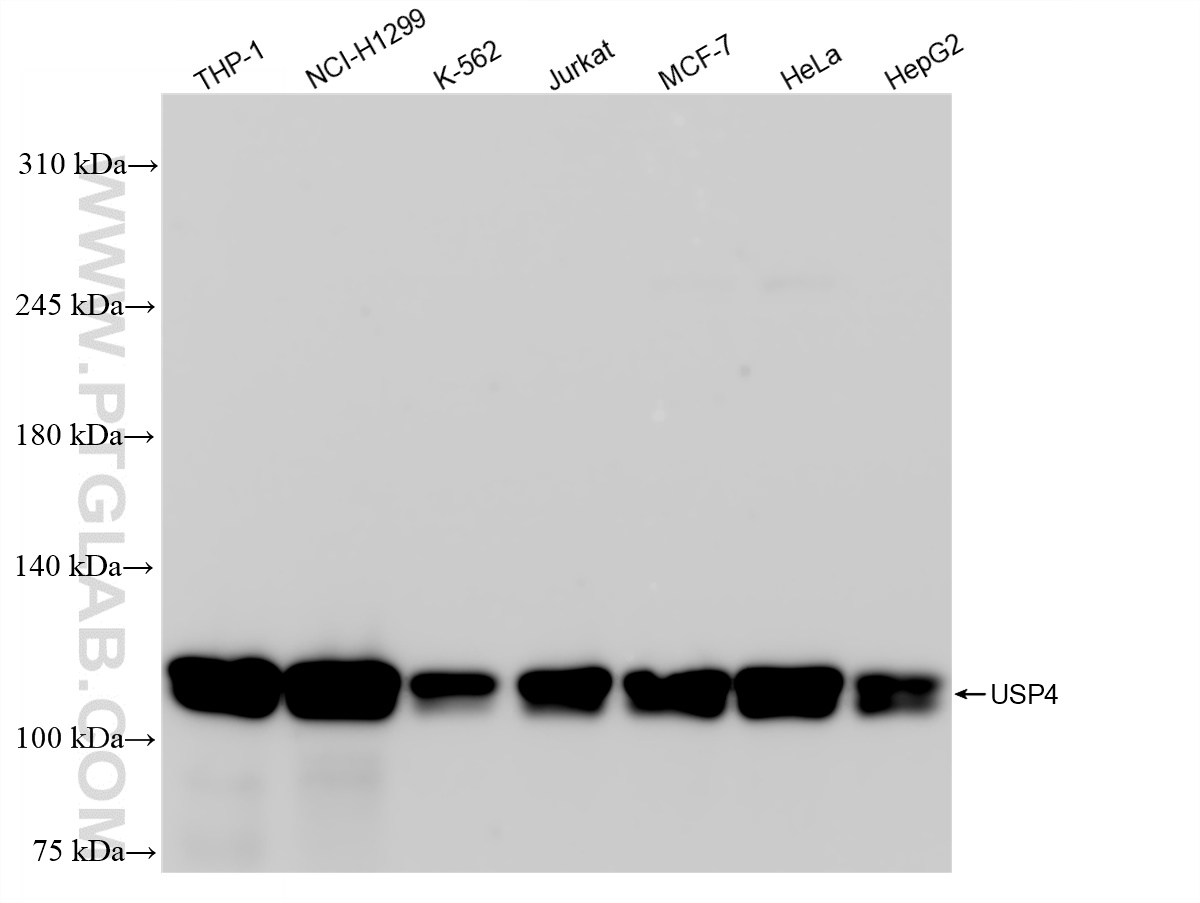 Western Blot (WB) analysis of various lysates using USP4 Recombinant antibody (83734-2-RR)