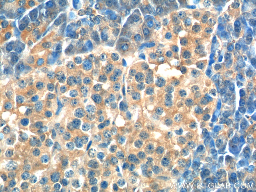 Immunohistochemistry (IHC) staining of human pancreas tissue using USP46 Polyclonal antibody (13502-1-AP)