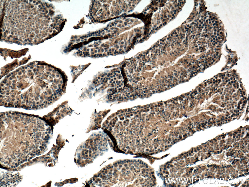 Immunohistochemistry (IHC) staining of mouse testis tissue using USP50 Polyclonal antibody (20374-1-AP)