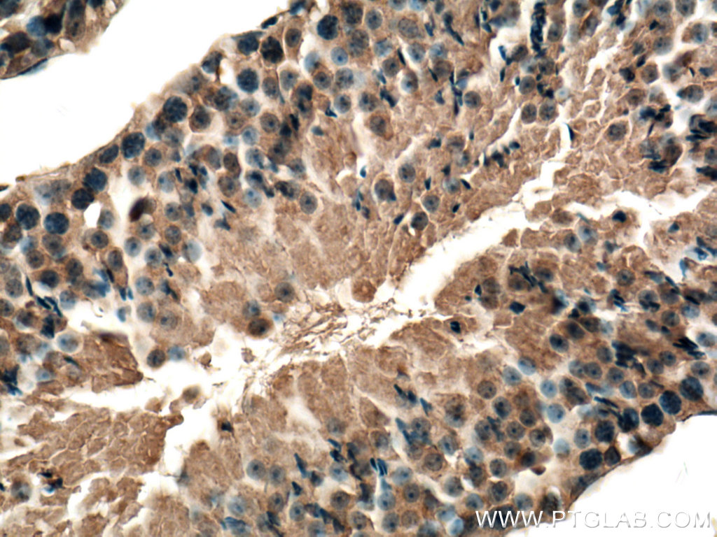 Immunohistochemistry (IHC) staining of mouse testis tissue using USP50 Polyclonal antibody (20374-1-AP)