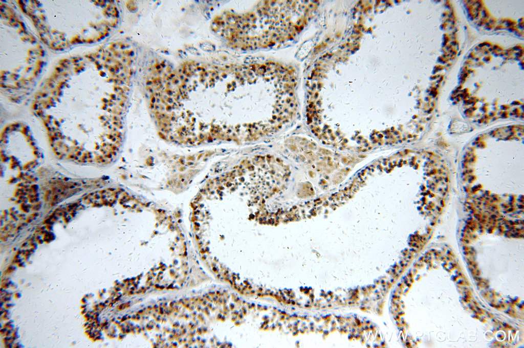 Immunohistochemistry (IHC) staining of human testis tissue using USP50 Polyclonal antibody (20374-1-AP)