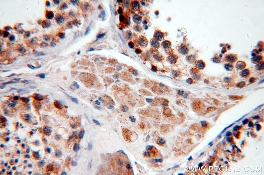 Immunohistochemistry (IHC) staining of human testis tissue using USP50 Polyclonal antibody (20374-1-AP)