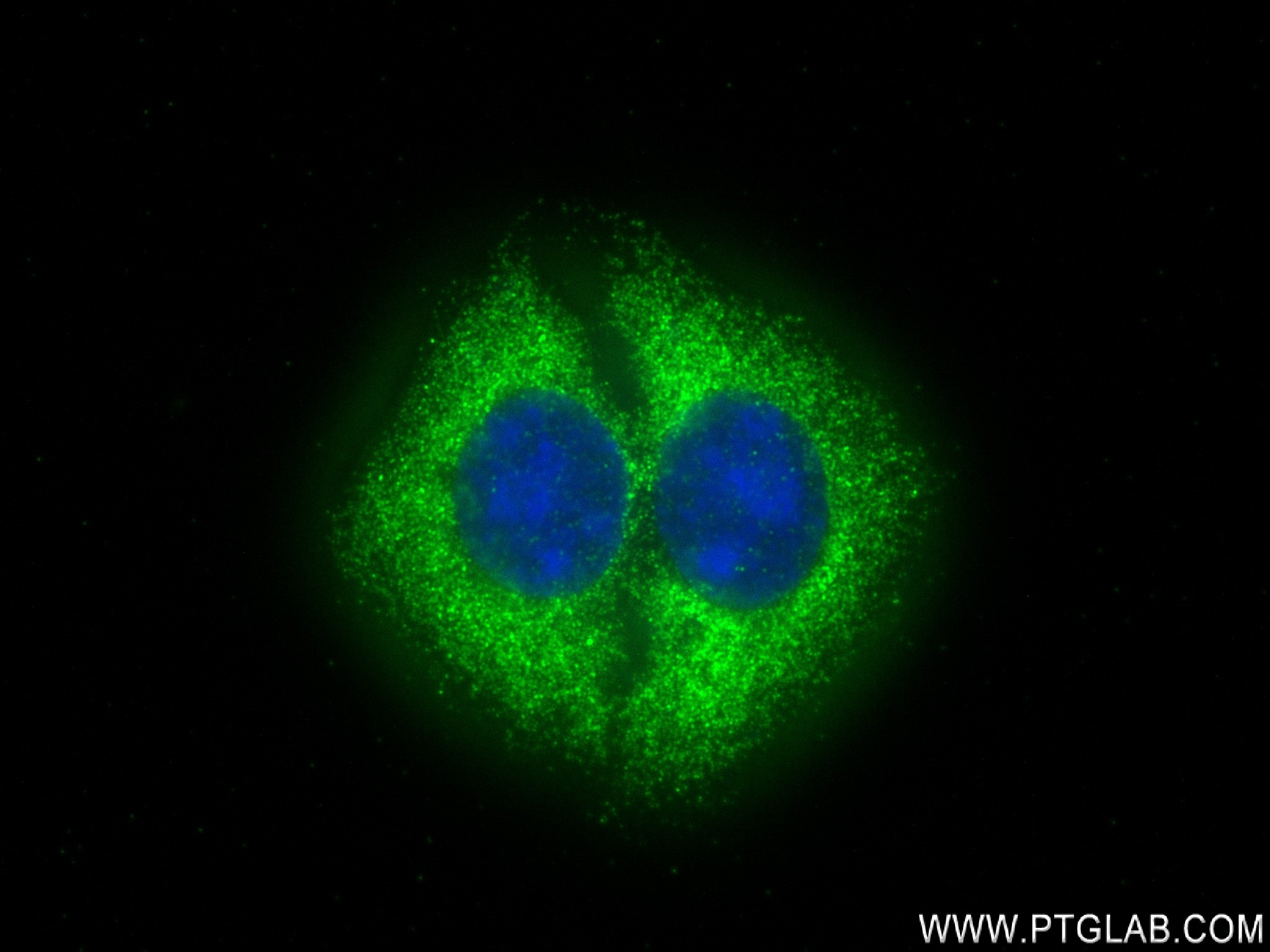 Immunofluorescence (IF) / fluorescent staining of U2OS cells using USP8 Recombinant antibody (83172-2-RR)