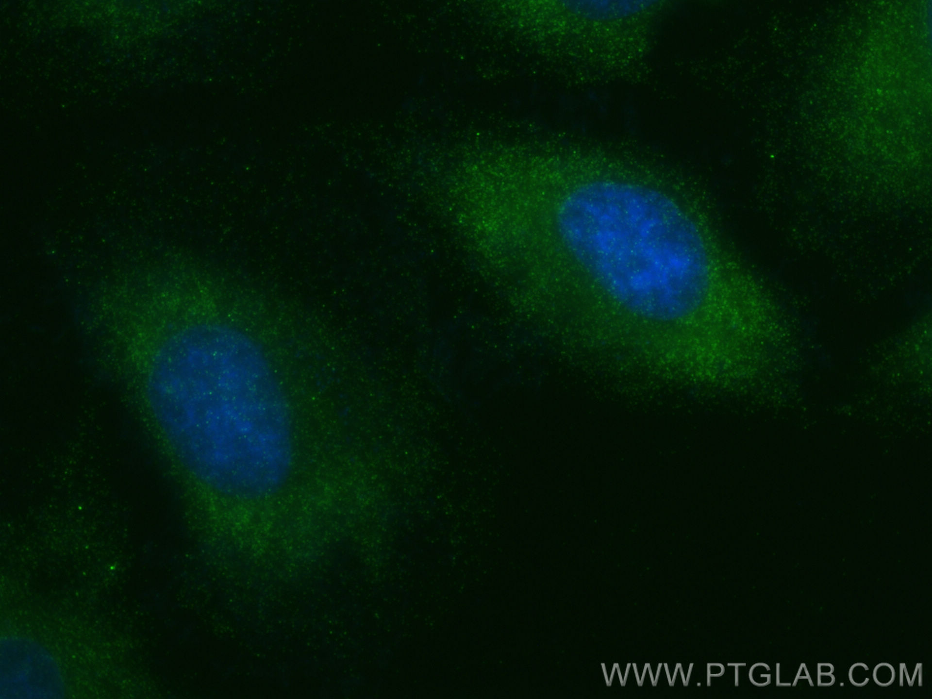 Immunofluorescence (IF) / fluorescent staining of HeLa cells using USP8 Recombinant antibody (83172-2-RR)