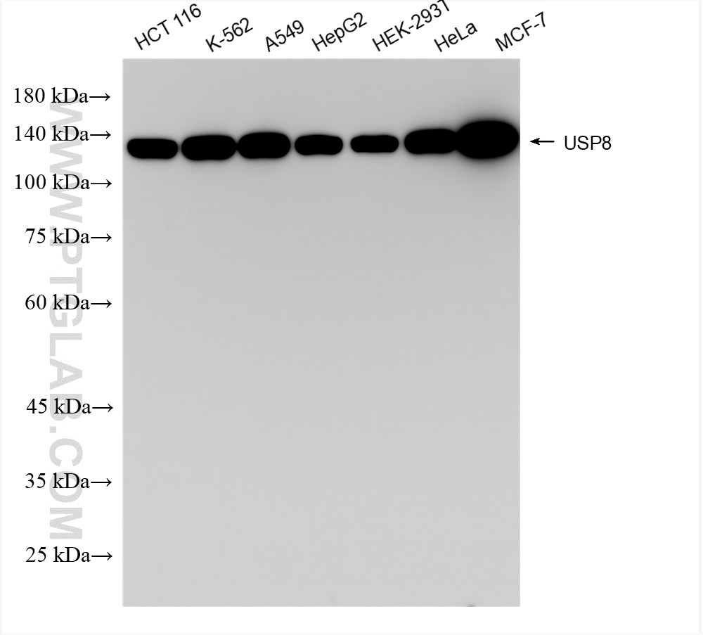 Western Blot (WB) analysis of various lysates using USP8 Recombinant antibody (83172-2-RR)