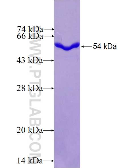 USP8 fusion protein Ag27143 SDS-PAGE