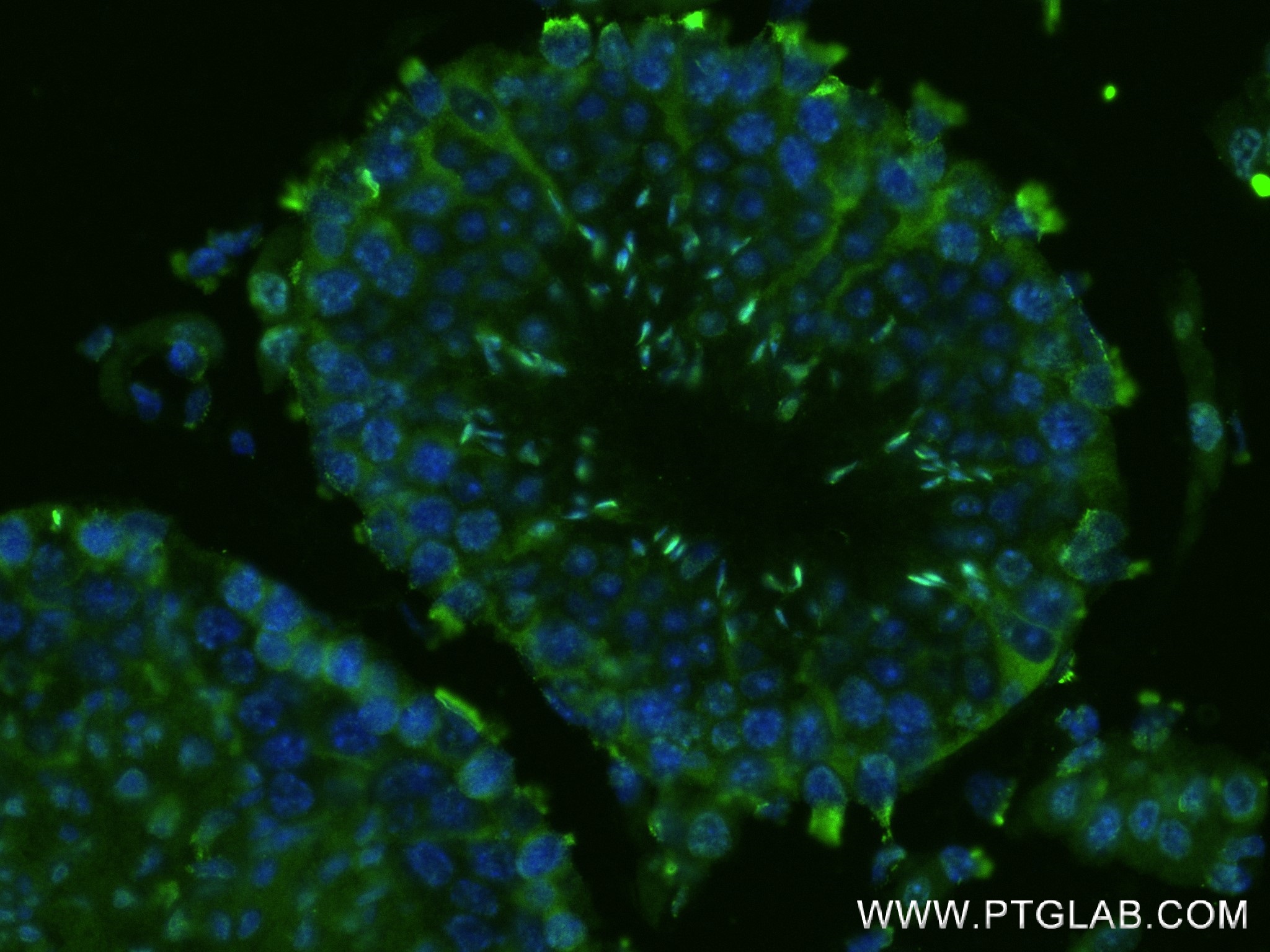 Immunofluorescence (IF) / fluorescent staining of mouse testis tissue using USP9X Recombinant antibody (81892-1-RR)