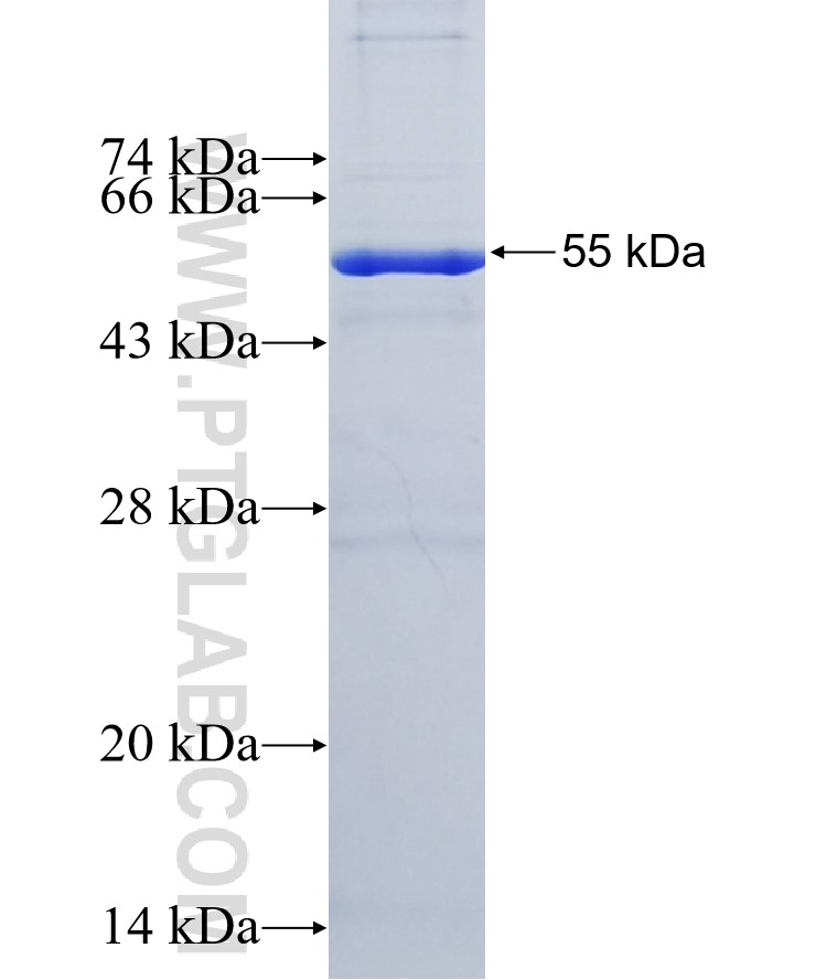 USPL1 fusion protein Ag27756 SDS-PAGE