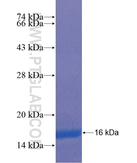 UTS2R fusion protein Ag21618 SDS-PAGE