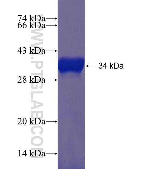 UTX fusion protein Ag21373 SDS-PAGE