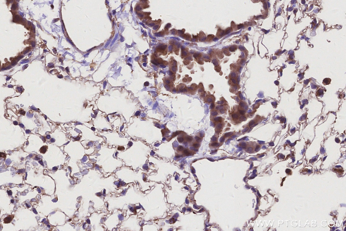 Immunohistochemistry (IHC) staining of mouse lung tissue using UVRAG Polyclonal antibody (29190-1-AP)