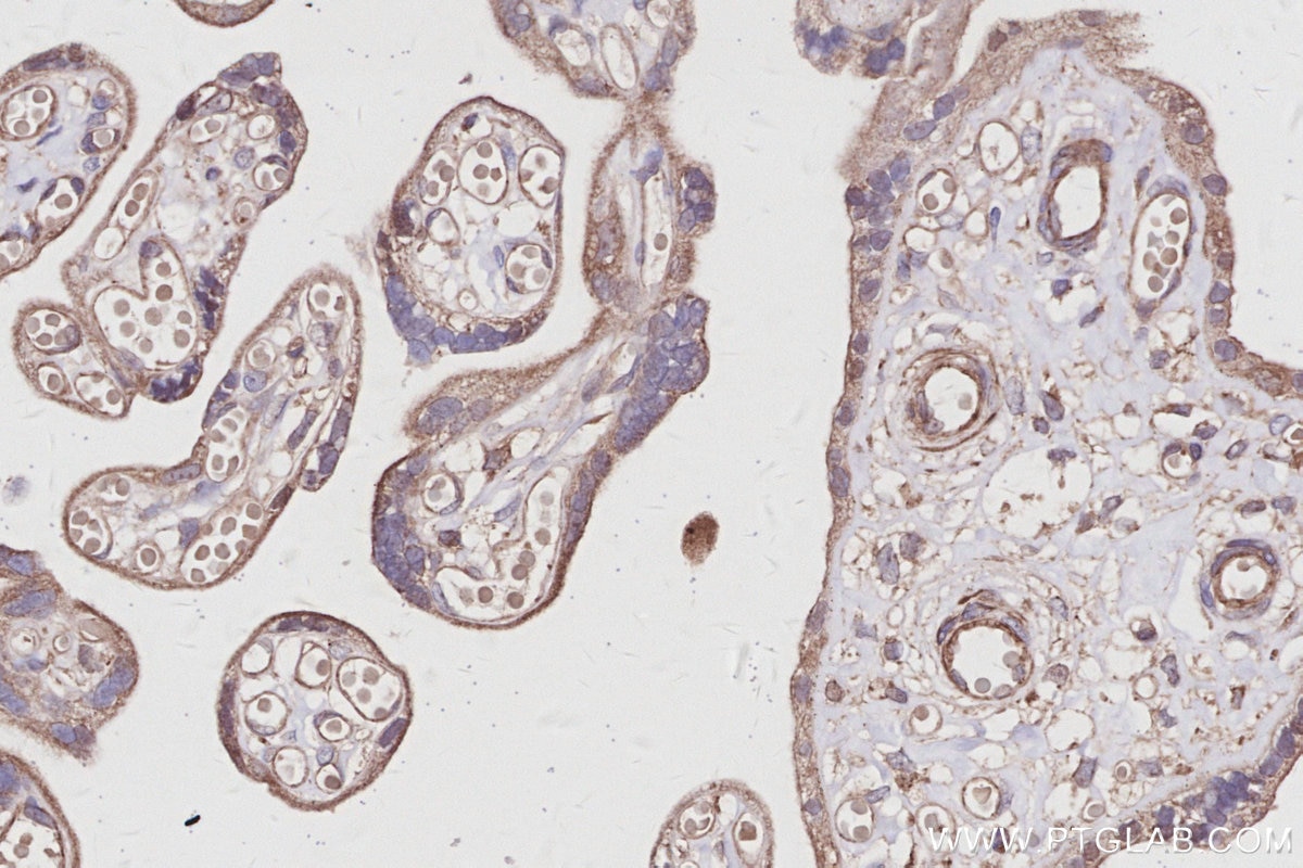 Immunohistochemistry (IHC) staining of human placenta tissue using UVRAG Polyclonal antibody (29190-1-AP)
