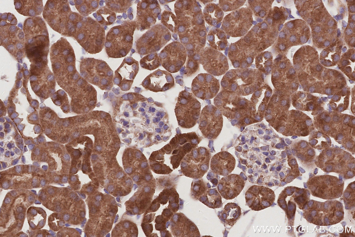 Immunohistochemistry (IHC) staining of mouse kidney tissue using UVRAG Polyclonal antibody (29190-1-AP)