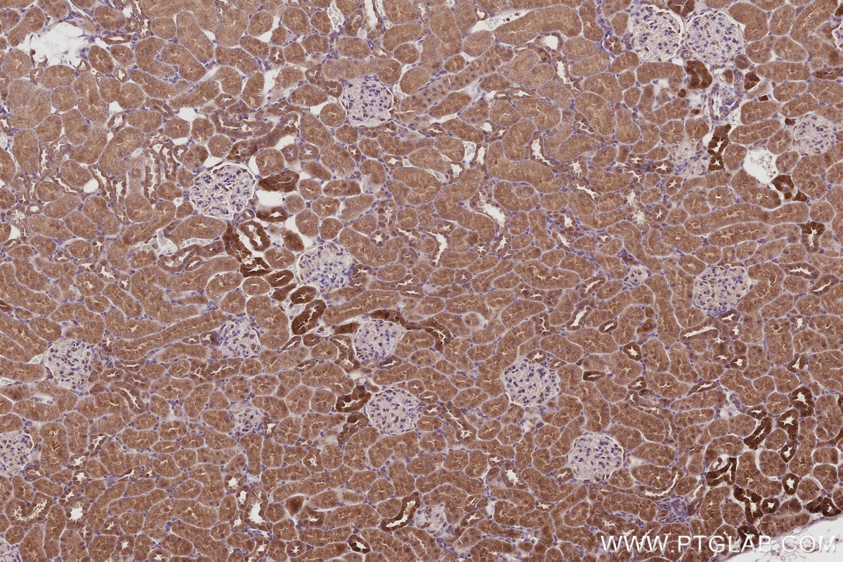 Immunohistochemistry (IHC) staining of rat kidney tissue using UVRAG Polyclonal antibody (29190-1-AP)