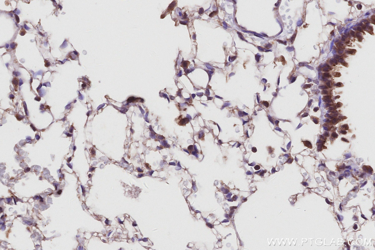 Immunohistochemistry (IHC) staining of rat lung tissue using UVRAG Polyclonal antibody (29190-1-AP)