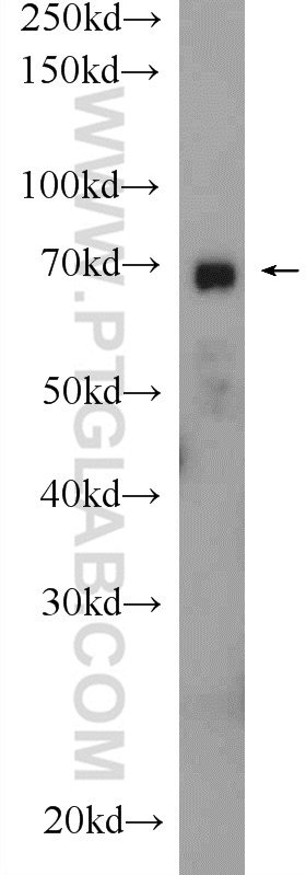 Western Blot (WB) analysis of rat heart tissue using Ubiquilin 1 Polyclonal antibody (22126-1-AP)