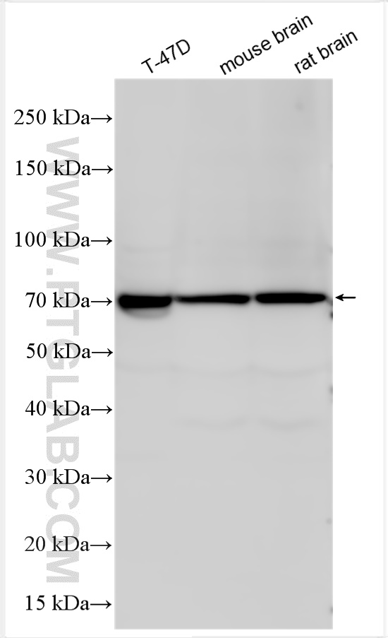 Western Blot (WB) analysis of various lysates using Ubiquilin 1 Polyclonal antibody (22126-1-AP)