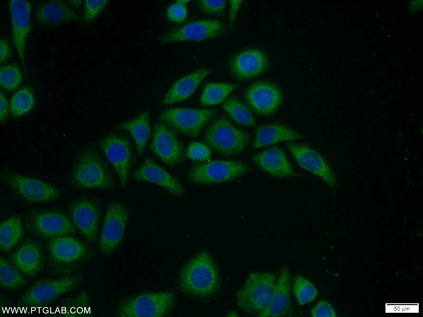 Immunofluorescence (IF) / fluorescent staining of PC-3 cells using Ubiquilin 1 Polyclonal antibody (23516-1-AP)