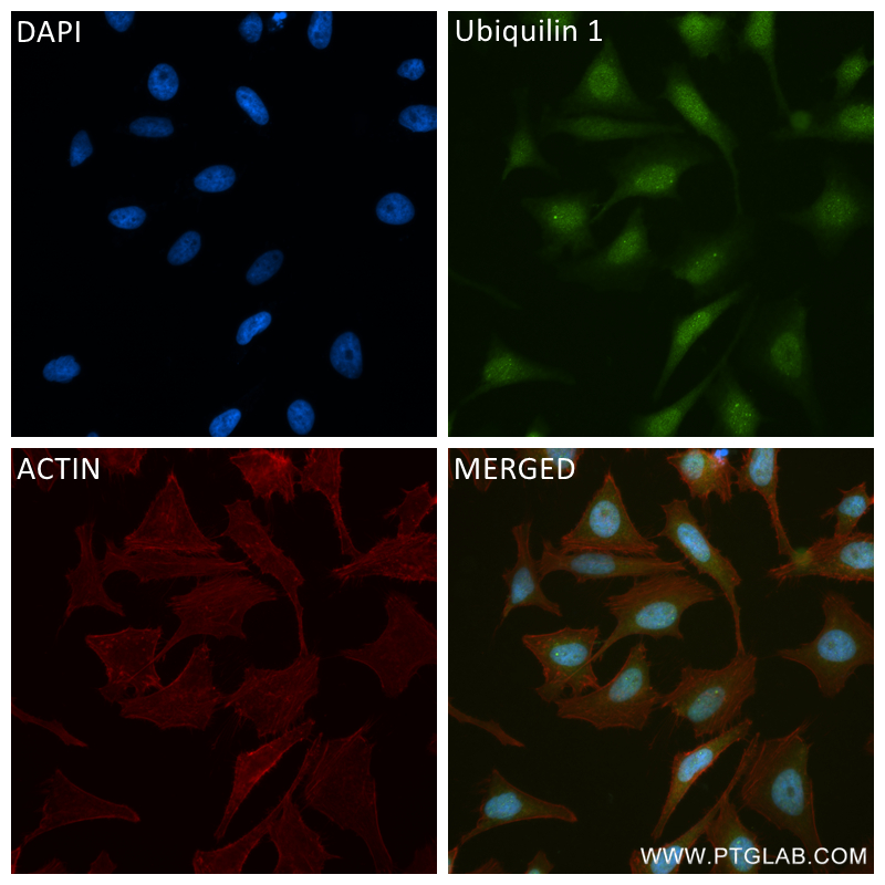 Immunofluorescence (IF) / fluorescent staining of HeLa cells using Ubiquilin 1 Recombinant antibody (84649-2-RR)