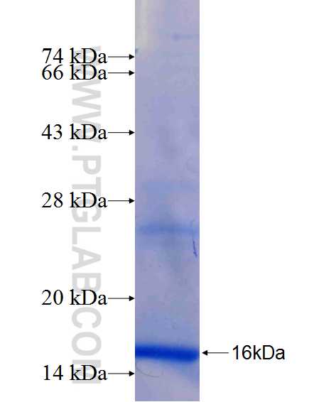 Uteroglobin fusion protein Ag26315 SDS-PAGE