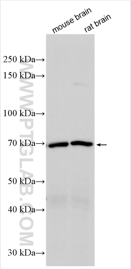 Western Blot (WB) analysis of various lysates using VAChT Polyclonal antibody (27303-1-AP)