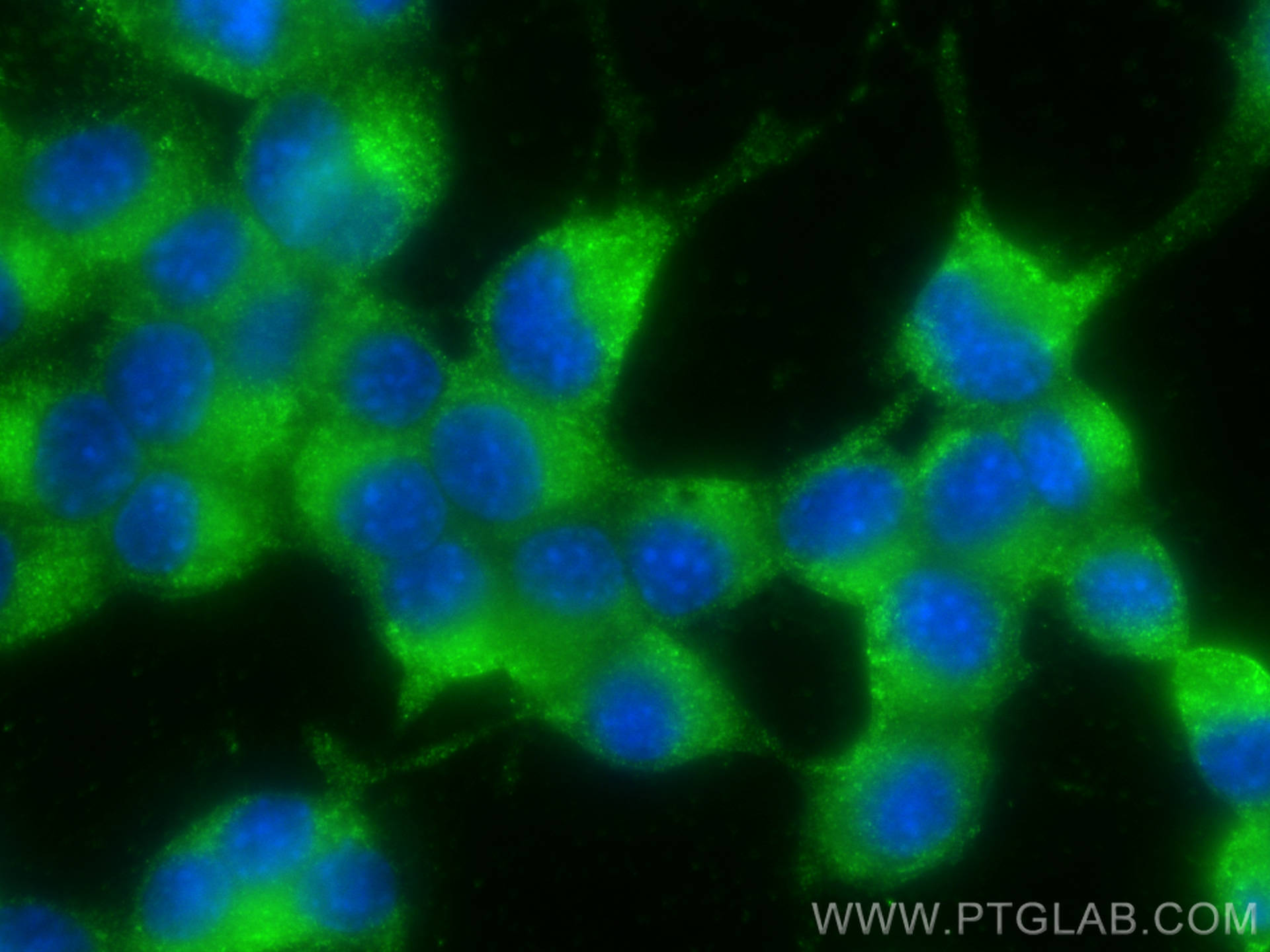 Immunofluorescence (IF) / fluorescent staining of Neuro-2a cells using VAMP3/Cellubrevin Monoclonal antibody (66488-1-Ig)