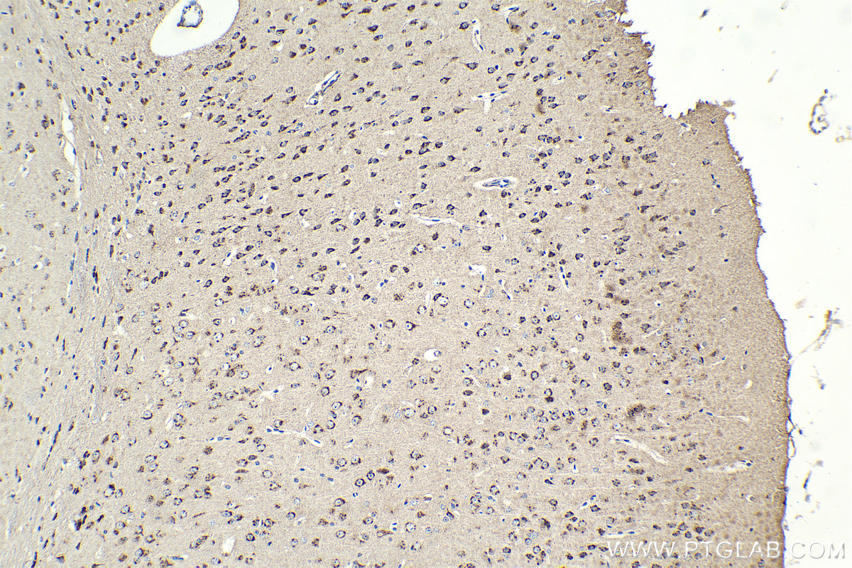 Immunohistochemistry (IHC) staining of mouse brain tissue using VAMP4 Polyclonal antibody (10738-1-AP)