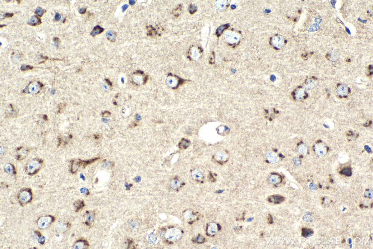 Immunohistochemistry (IHC) staining of mouse brain tissue using VAMP4 Polyclonal antibody (10738-1-AP)