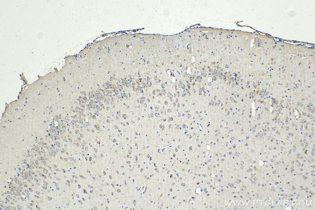 Immunohistochemistry (IHC) staining of rat brain tissue using VAMP4 Polyclonal antibody (10738-1-AP)