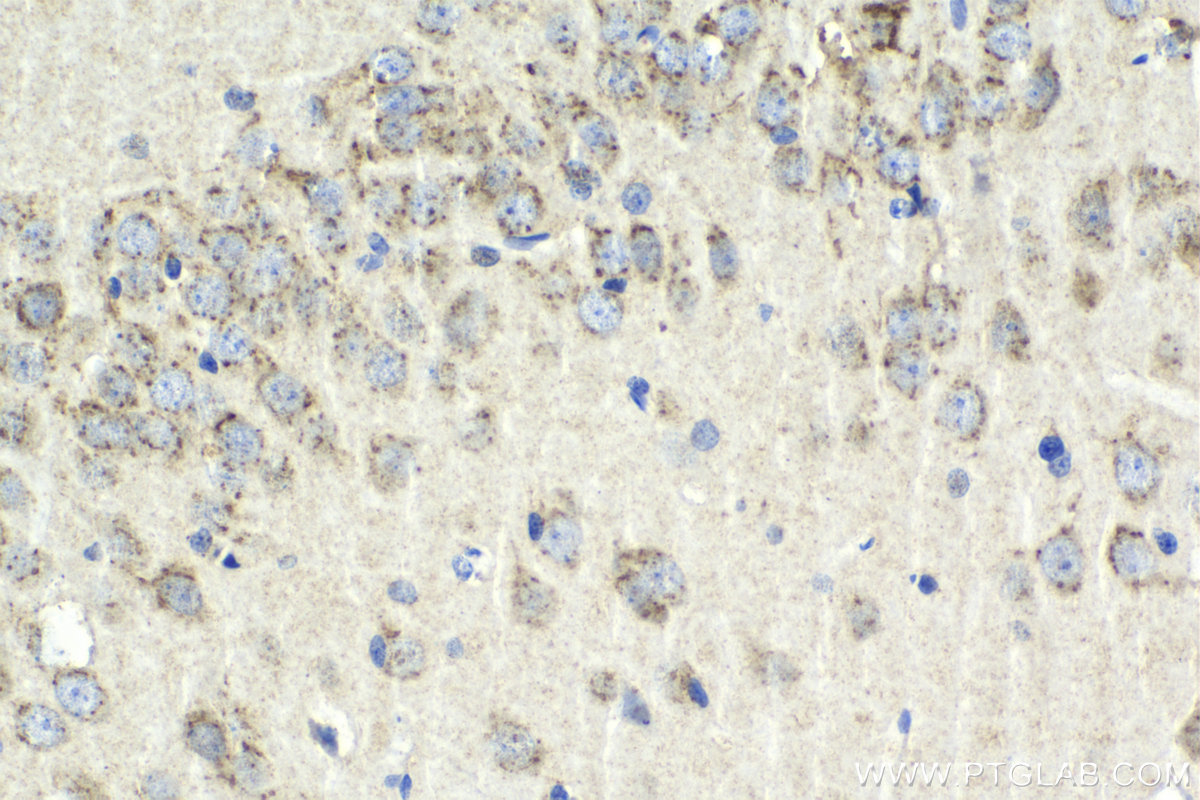 Immunohistochemistry (IHC) staining of rat brain tissue using VAMP4 Polyclonal antibody (10738-1-AP)