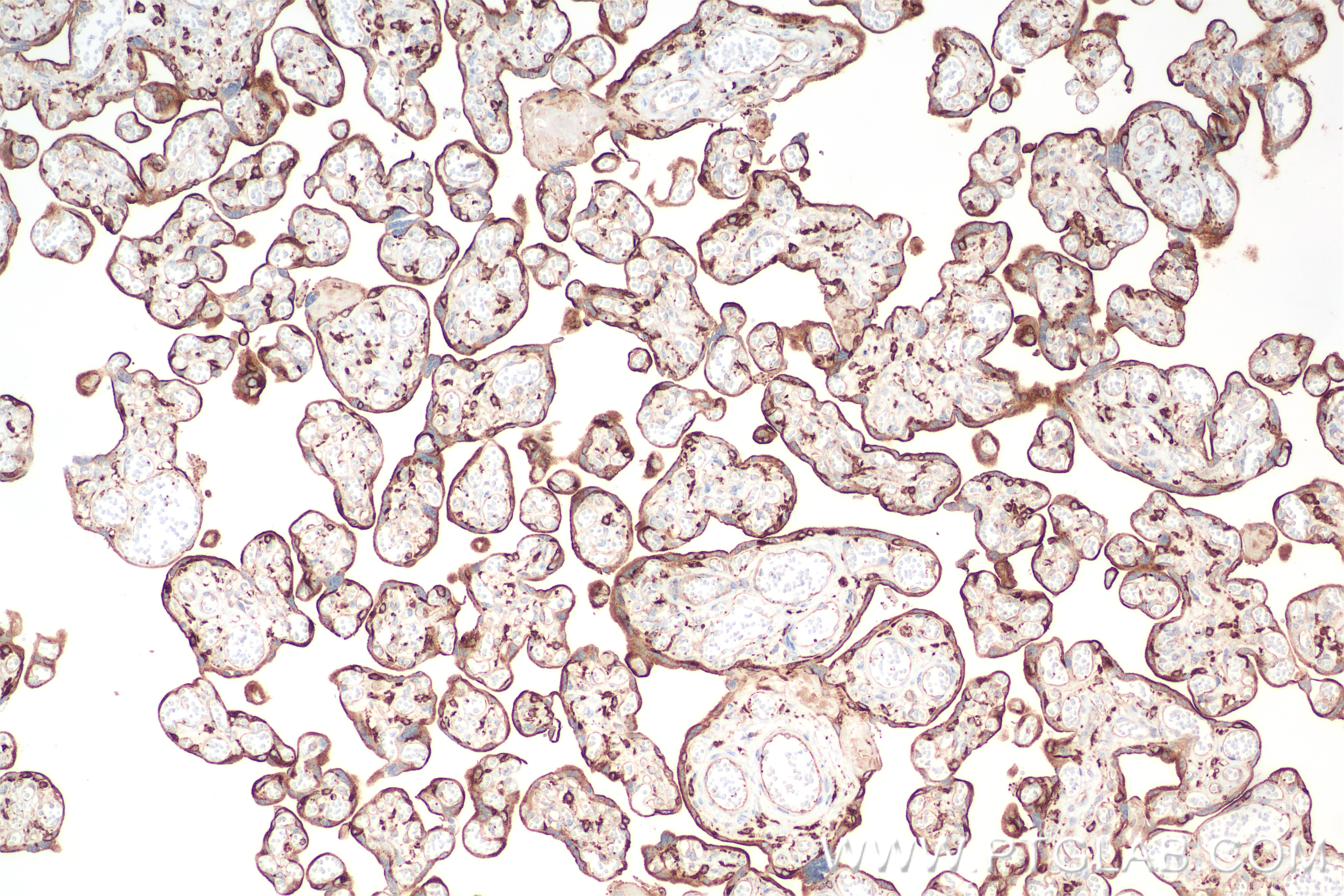 Immunohistochemistry (IHC) staining of human placenta tissue using VAMP8 Recombinant antibody (85400-4-RR)