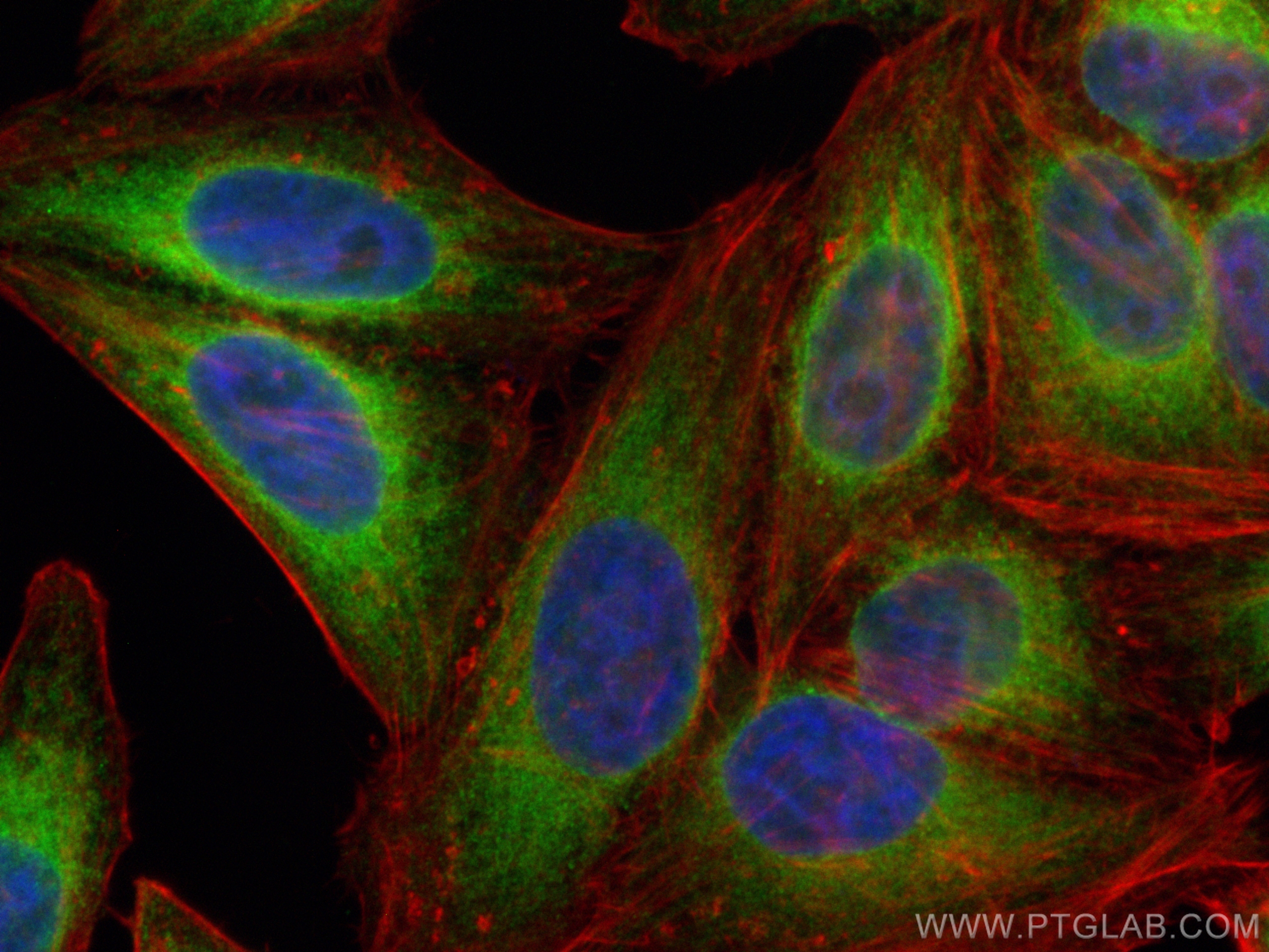 Immunofluorescence (IF) / fluorescent staining of HepG2 cells using CoraLite® Plus 488-conjugated VAPA Polyclonal anti (CL488-15275)