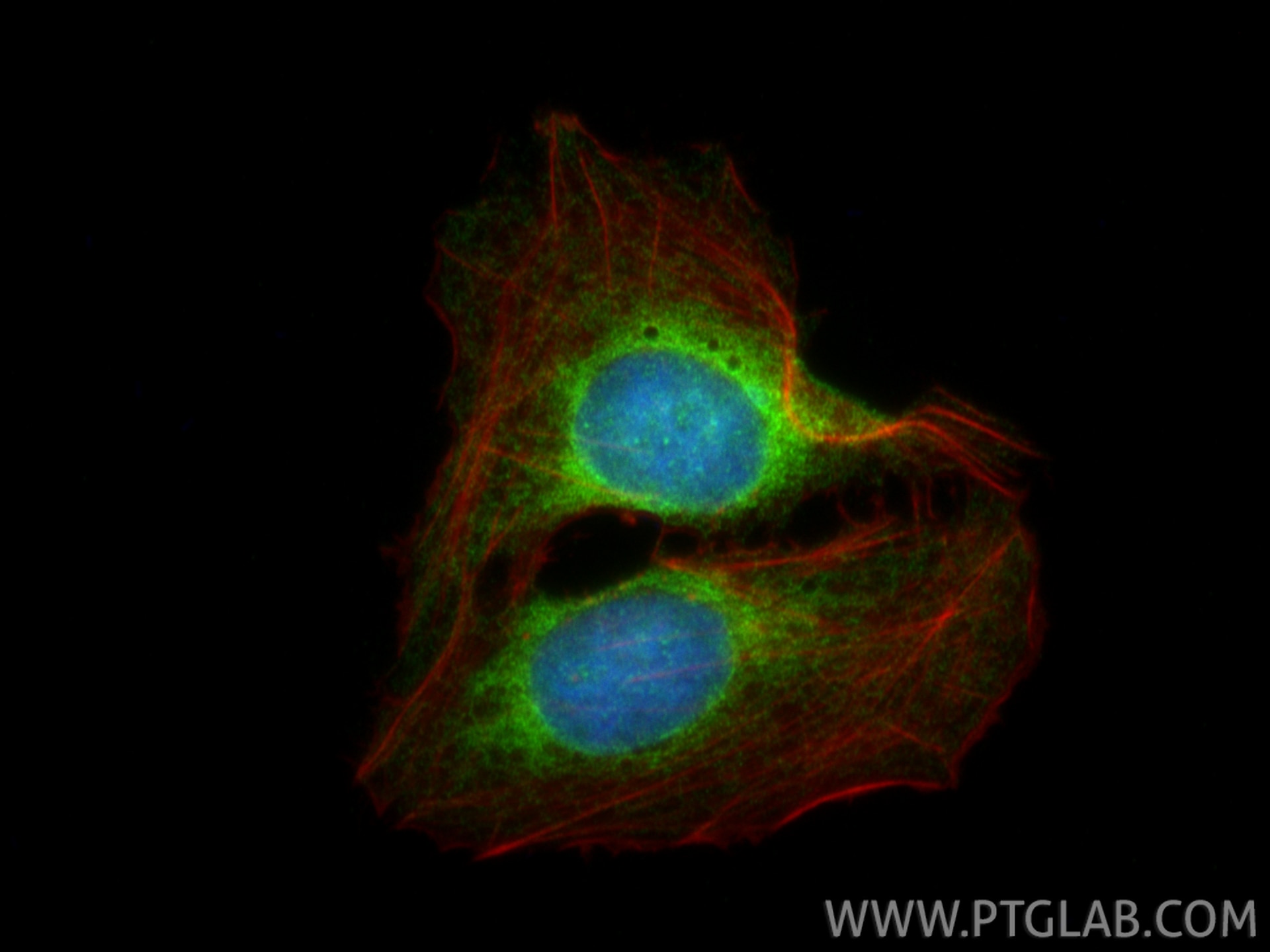 Immunofluorescence (IF) / fluorescent staining of U2OS cells using VAPB Polyclonal antibody (14477-1-AP)
