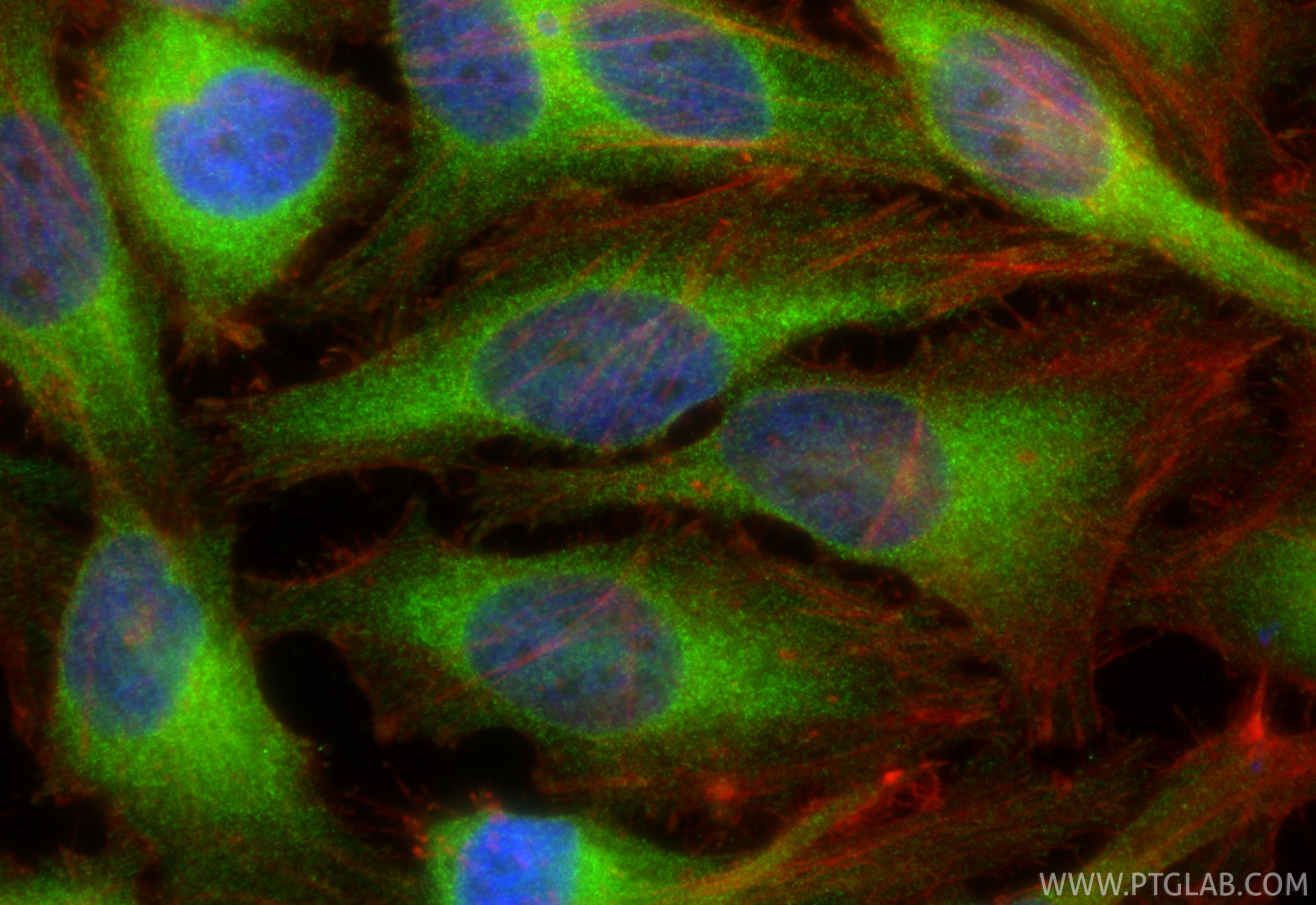 Immunofluorescence (IF) / fluorescent staining of HeLa cells using VAPB Monoclonal antibody (66191-1-Ig)
