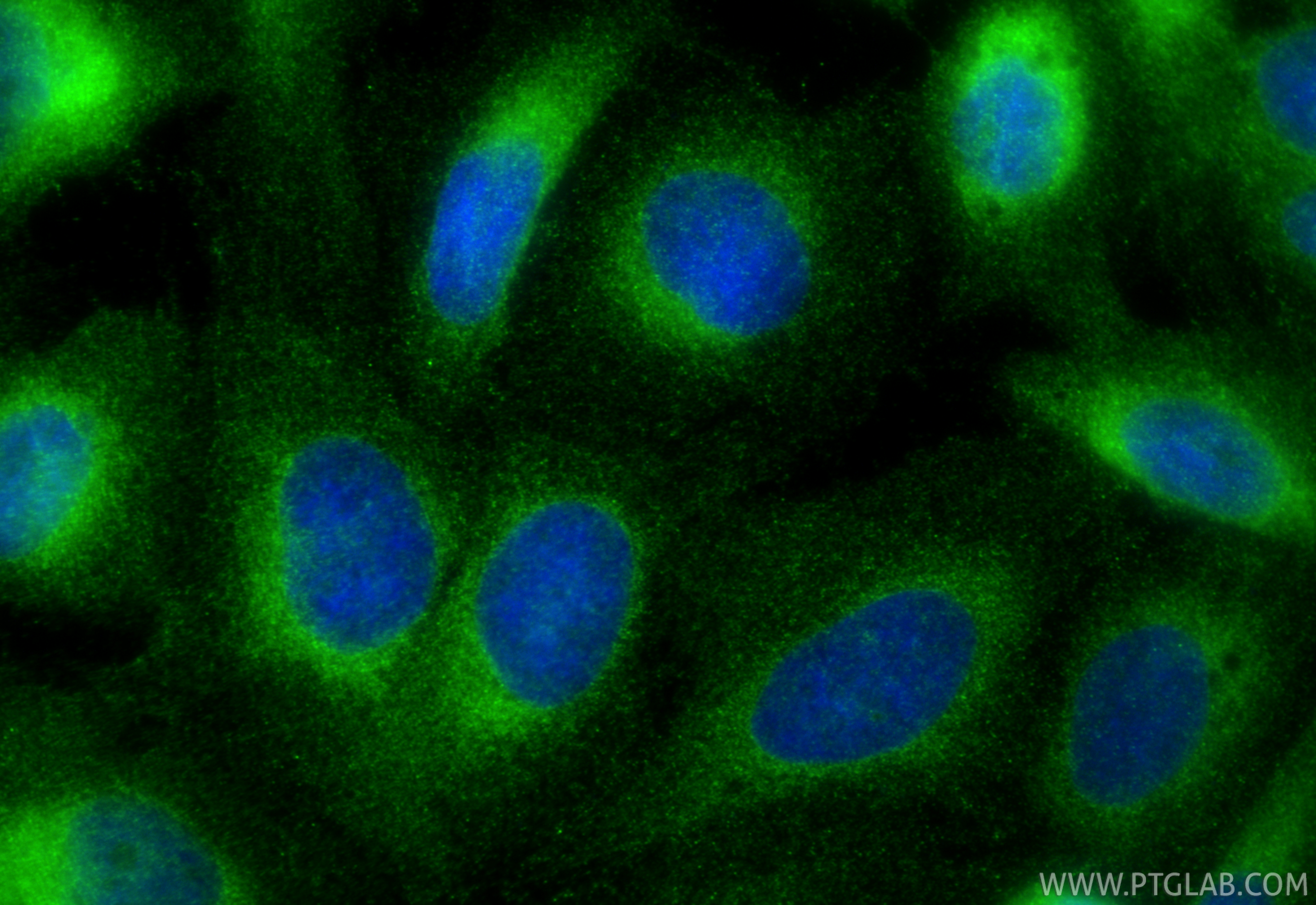 Immunofluorescence (IF) / fluorescent staining of U2OS cells using VAPB Monoclonal antibody (66191-1-Ig)