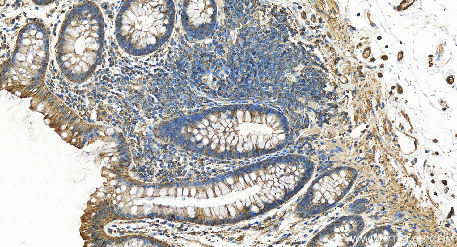 Immunohistochemistry (IHC) staining of human normal colon using VASP Polyclonal antibody (13472-1-AP)