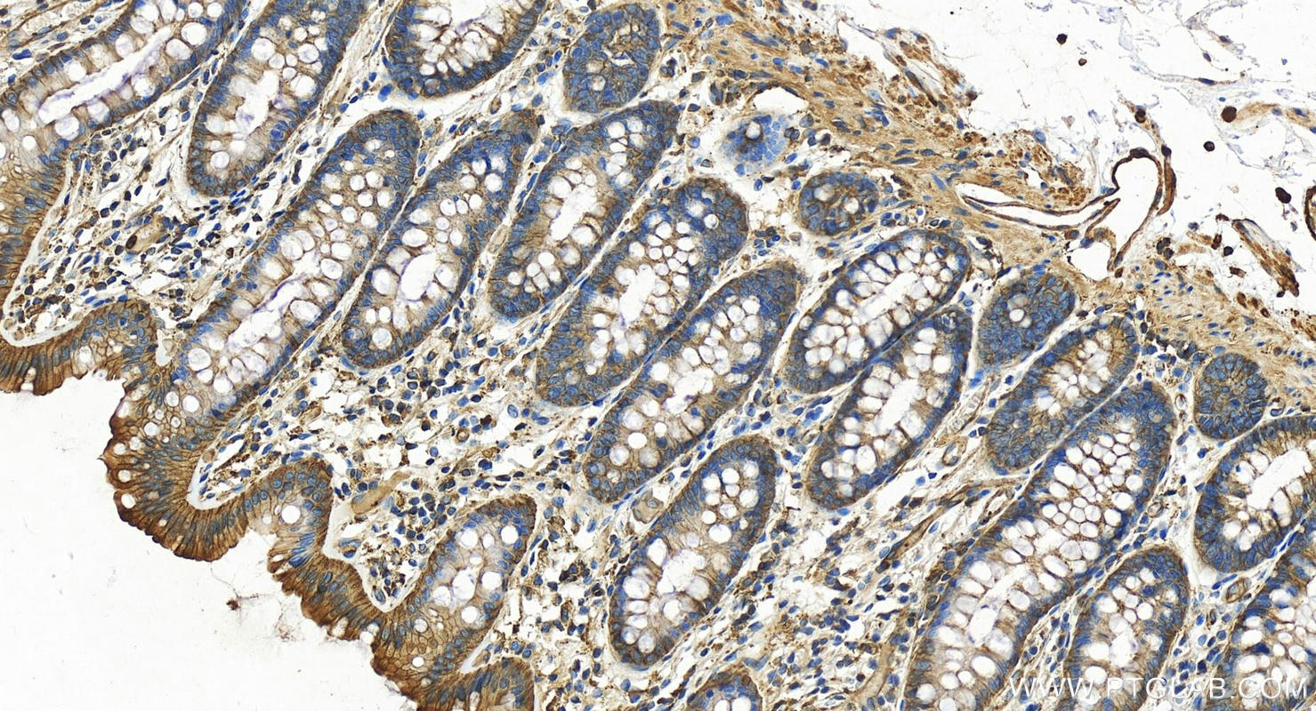 Immunohistochemistry (IHC) staining of human normal colon using VASP Polyclonal antibody (13472-1-AP)