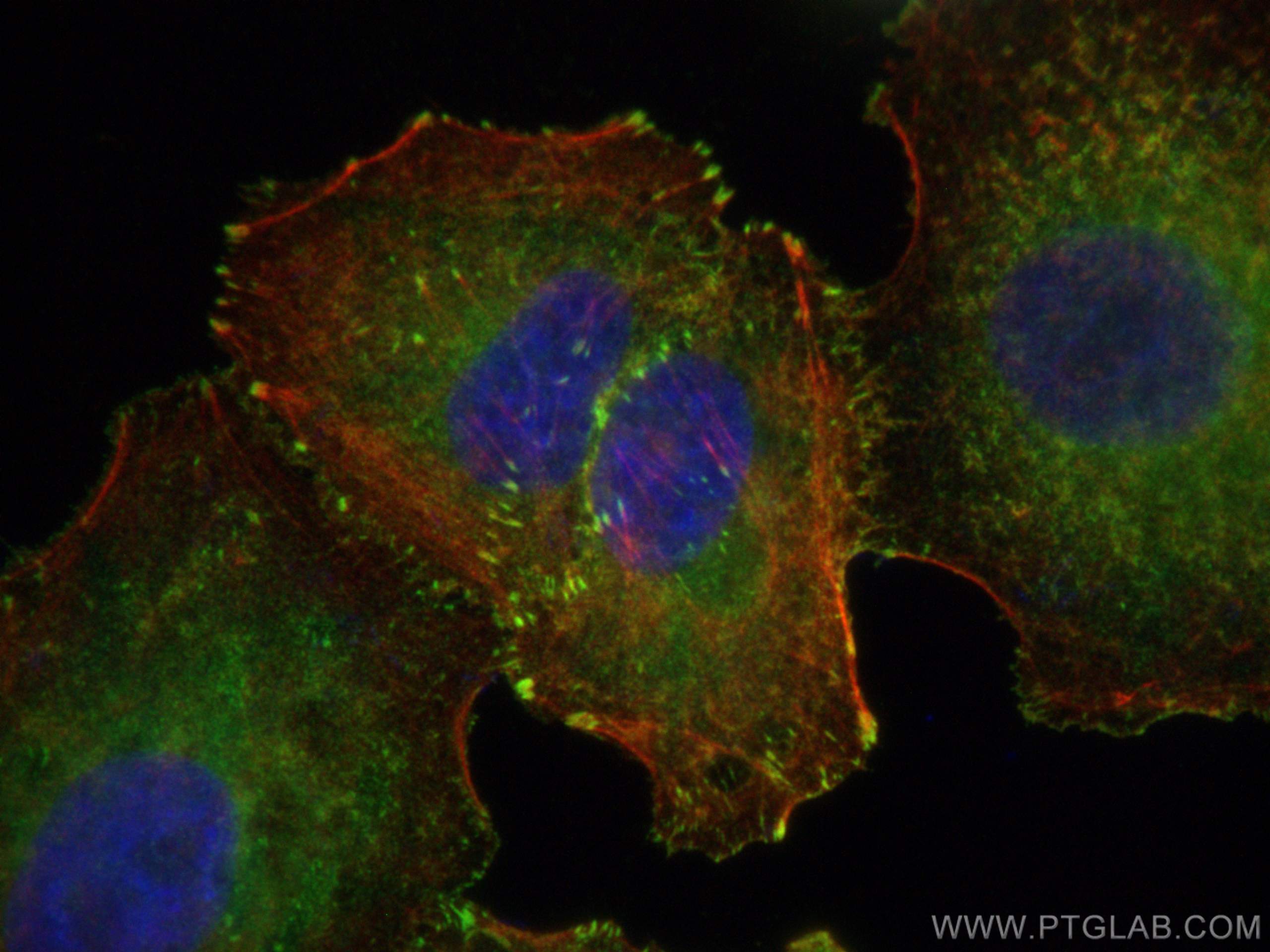 Immunofluorescence (IF) / fluorescent staining of A549 cells using VASP Polyclonal antibody (13472-1-AP)