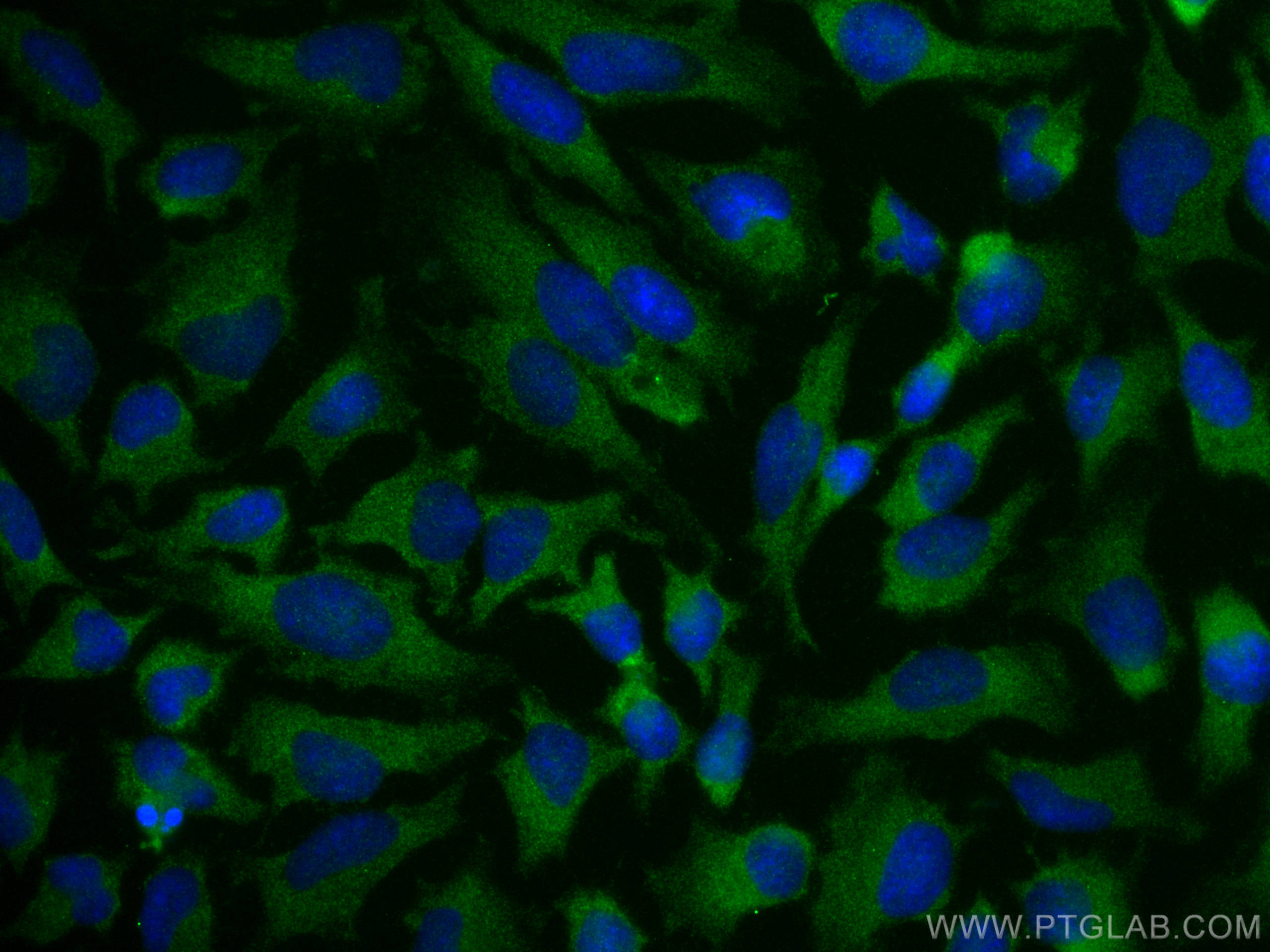 Immunofluorescence (IF) / fluorescent staining of HeLa cells using VAV2 Polyclonal antibody (21924-1-AP)