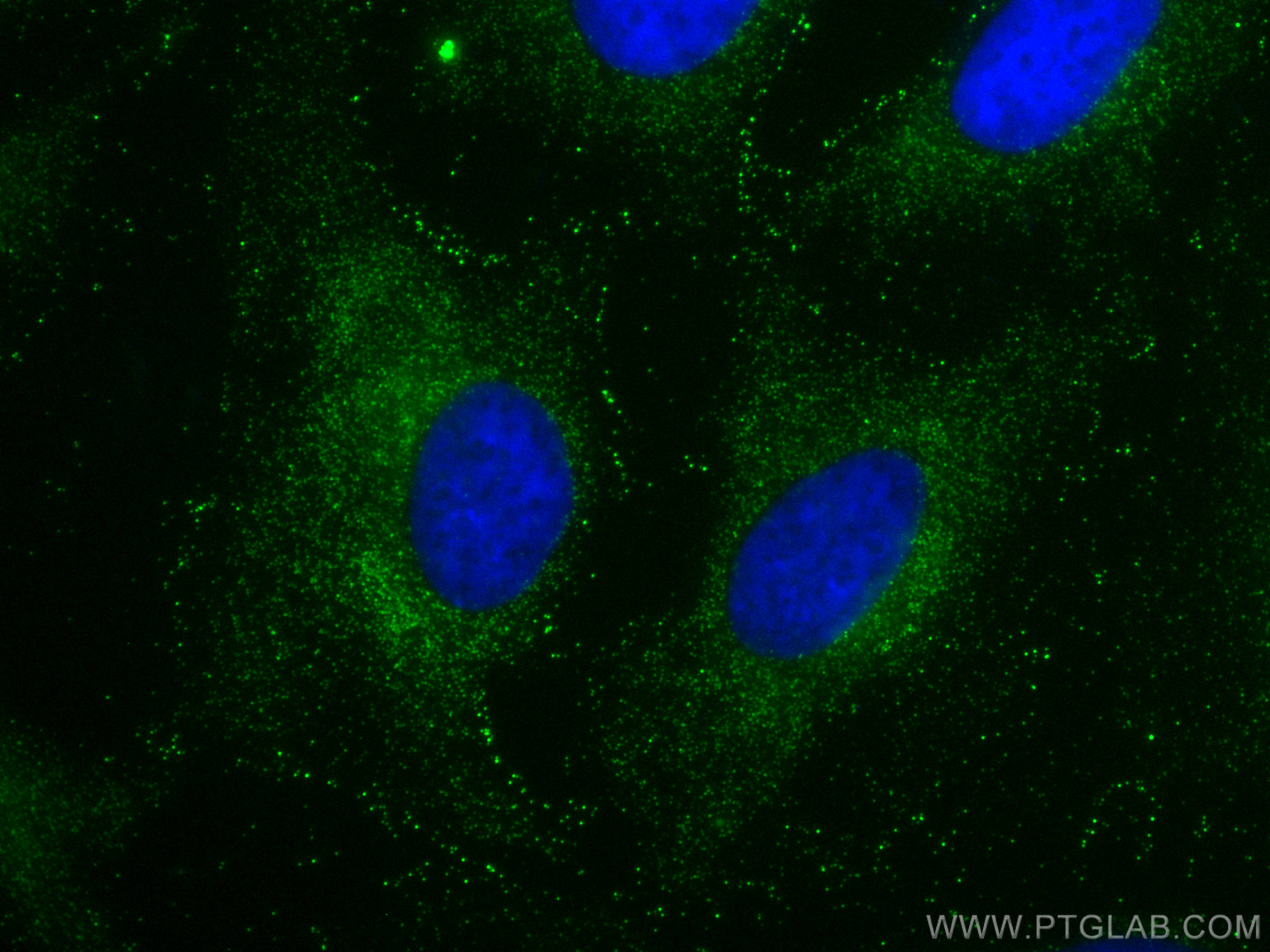 Immunofluorescence (IF) / fluorescent staining of HeLa cells using VAV3 Polyclonal antibody (30291-1-AP)