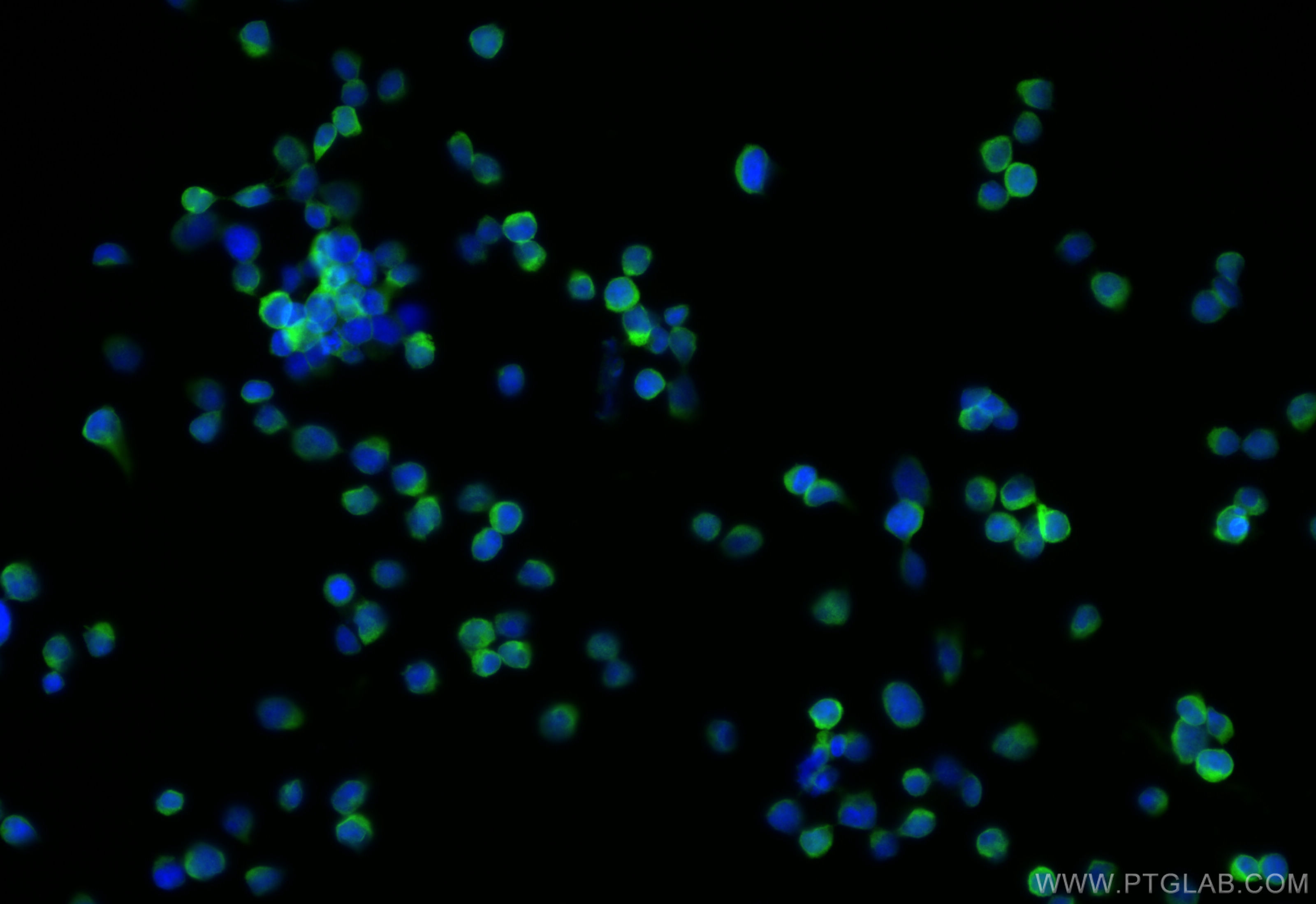 Immunofluorescence (IF) / fluorescent staining of Jurkat cells using VAV3 Polyclonal antibody (30291-1-AP)