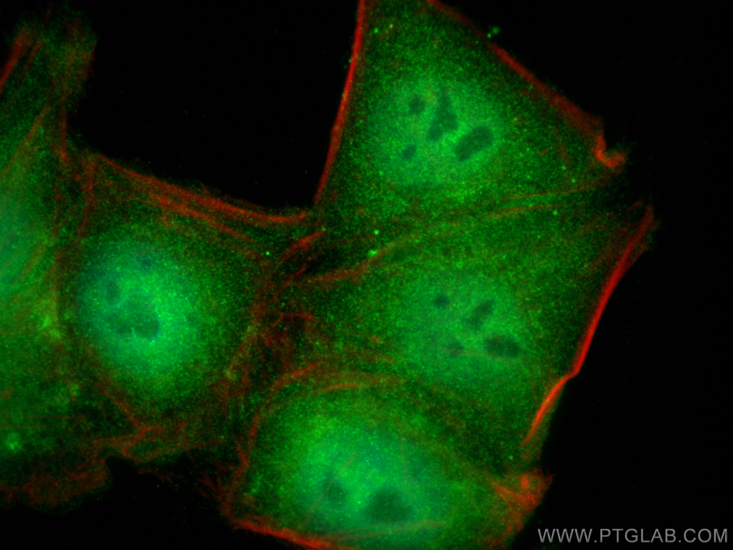 Immunofluorescence (IF) / fluorescent staining of HepG2 cells using VBP1 Polyclonal antibody (14345-1-AP)