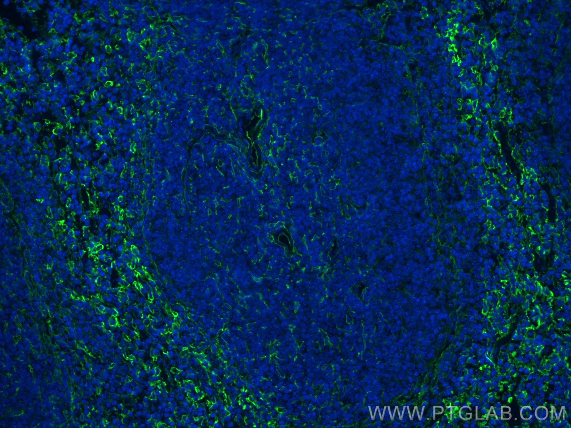 Immunofluorescence (IF) / fluorescent staining of mouse spleen tissue using VCAM-1/CD106 Polyclonal antibody (30958-1-AP)