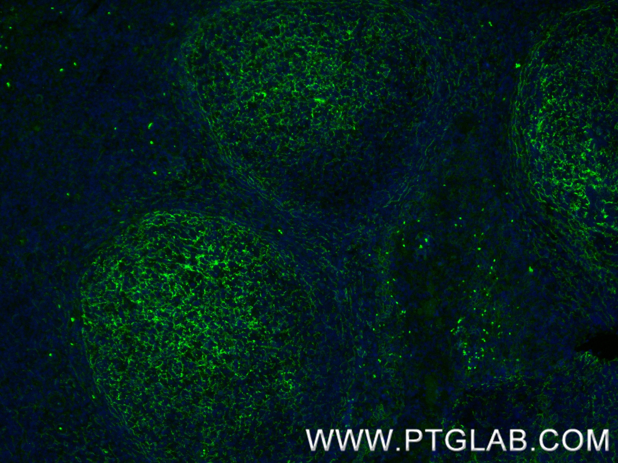 Immunofluorescence (IF) / fluorescent staining of human tonsillitis tissue using VCAM-1/CD106 Recombinant antibody (84249-4-RR)